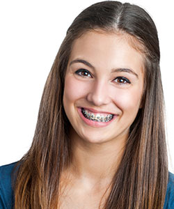 Braces and Orthodontics Near Me in Mountain View, CA