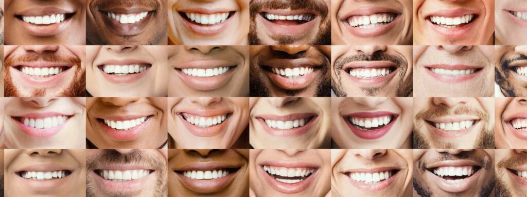 Your Best Dentist Experience Near You in San Francisco Bay