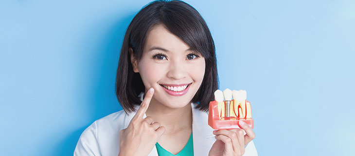 Implant Dentist Near Me in Bay Area, Mountain View, CA