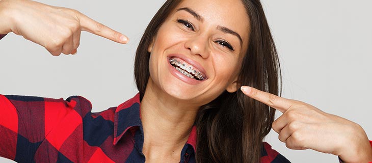 Braces Cost Without Insurance Near Me in Mountain View, CA