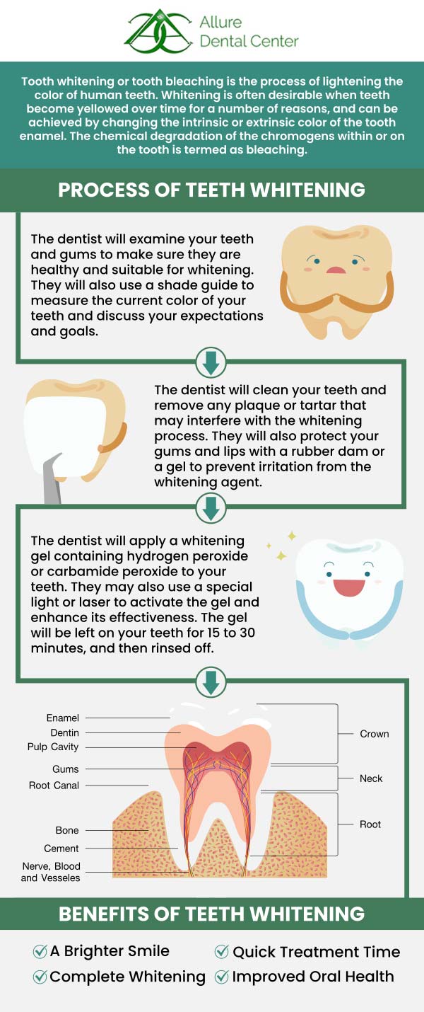 At ABC Dental Center, our dentists Dr. Trinh Lee and Dr. Suzanna Lee offer quality teeth whitening, including Zoom! In-office treatment, KöR Whitening, and custom whitening trays which are effective ways to impact your appearance and achieve the bright smile you want. For more information, contact us or schedule an online appointment. We are conveniently located at 570 N Shoreline Blvd Mountain View, CA 94043.