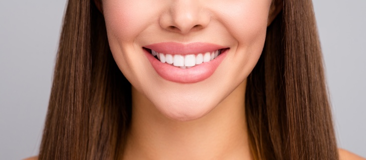What is the Process for Getting Veneers? - ABC Dental Center in Mountain View, CA